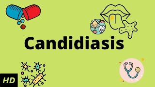 CANDIDIASIS Causes Signs and Symptoms Diagnosis and Treatment [upl. by Parik]