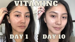 adding VITAMIN C serum to my skincare routine for 10 days  Vichy LiftActiv before amp after [upl. by Eenot168]