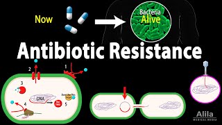 Antibiotic Resistance Animation [upl. by Quiteria]