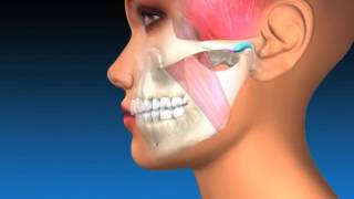 TMJ Explanation amp Therapy [upl. by Eednus]