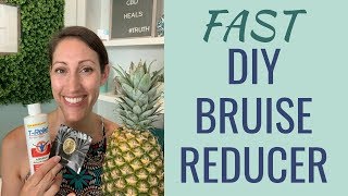 DIY Natural Bruise Treatment  How to Get Rid of a Bruise Fast  Best Home Remedy for Bruises [upl. by Aenit676]