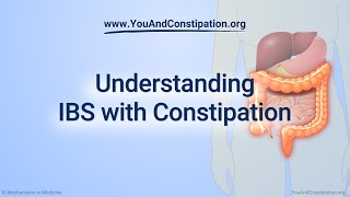 Understanding IBS with Constipation [upl. by Ecire]