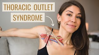 Thoracic Outlet Syndrome Exercises HOW TO FIX IT  Causes Symptoms amp Treatment [upl. by Anyotal218]