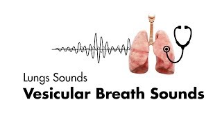 Vesicular Breath Sounds  Normal Lung Sounds  MEDZCOOL [upl. by Trude]