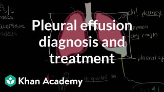 Pleural effusion diagnosis and treatment  Respiratory system diseases  NCLEXRN  Khan Academy [upl. by Ybok]