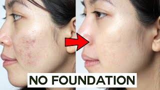 How to Cover Acne amp Blemishes WITHOUT Foundation • easy amp non cakey [upl. by Adniral661]