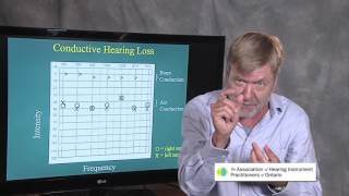 Ted Venema Talks Reading the Audiogram [upl. by Yrocej36]