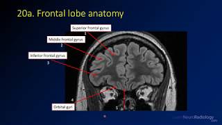 Neuroradiology review  brain gyral anatomy [upl. by Nyraf644]