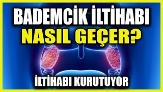 Bademcik Şişmesine Ne iyi Gelir Bademcik İltihabı Nasıl Geçer [upl. by Kant]