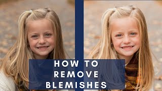 How to Remove Blemishes in Lightroom [upl. by Lebyram]