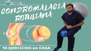 CONDROMALACIA ROTULIANA  10 EJERCICIOS y RECOMENDACIONES  Fisiolution [upl. by Blight294]