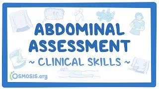 Abdominal Assessment Clinical Skills [upl. by Benilda553]